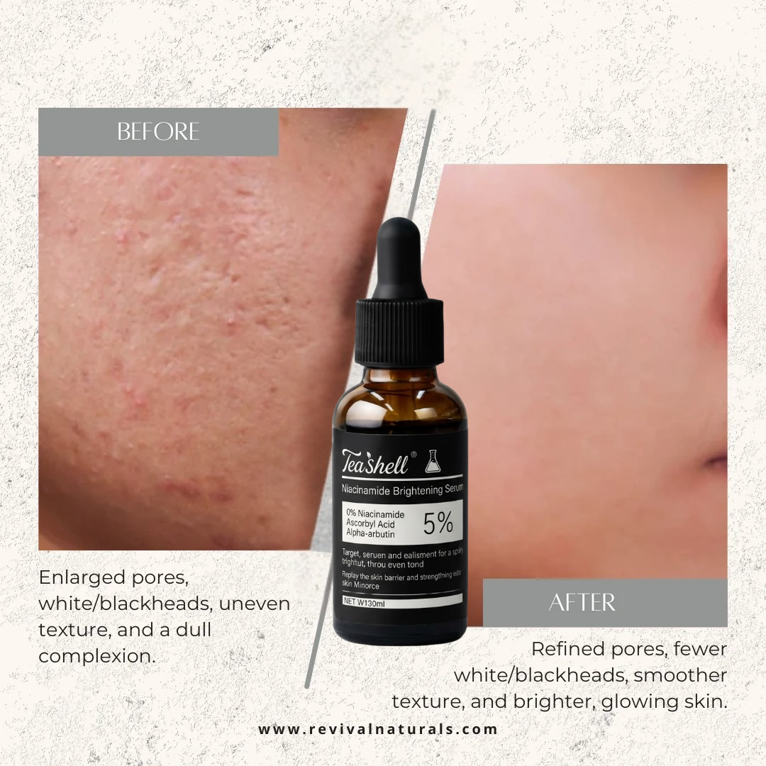 Teashell Niacinamide Brightening Serum |BUY ONE GET ONE FREE/ Fades Dark Spots, Evens Skin Tone & Boosts Glow